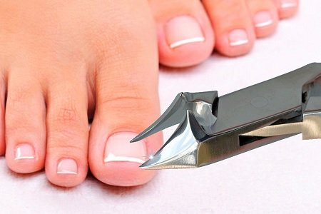 uñero-podosalud-peru